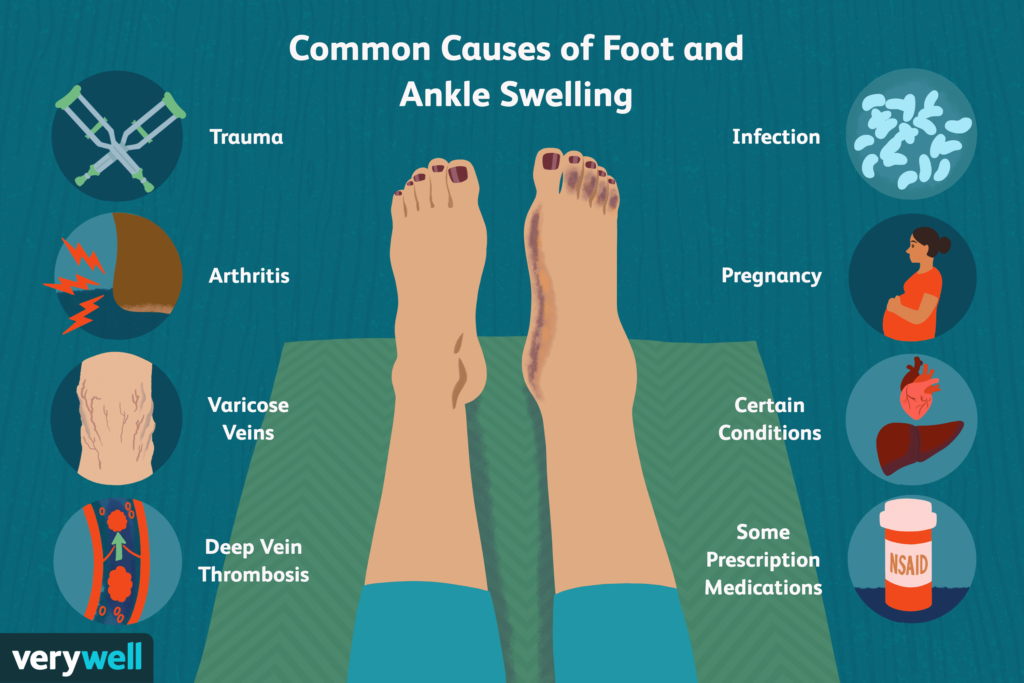 foot and ankle injury causes