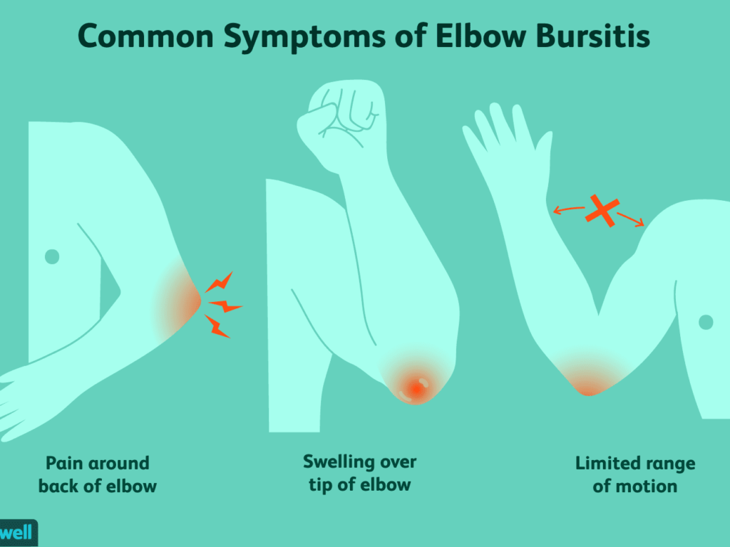 symptoms of elbow injury