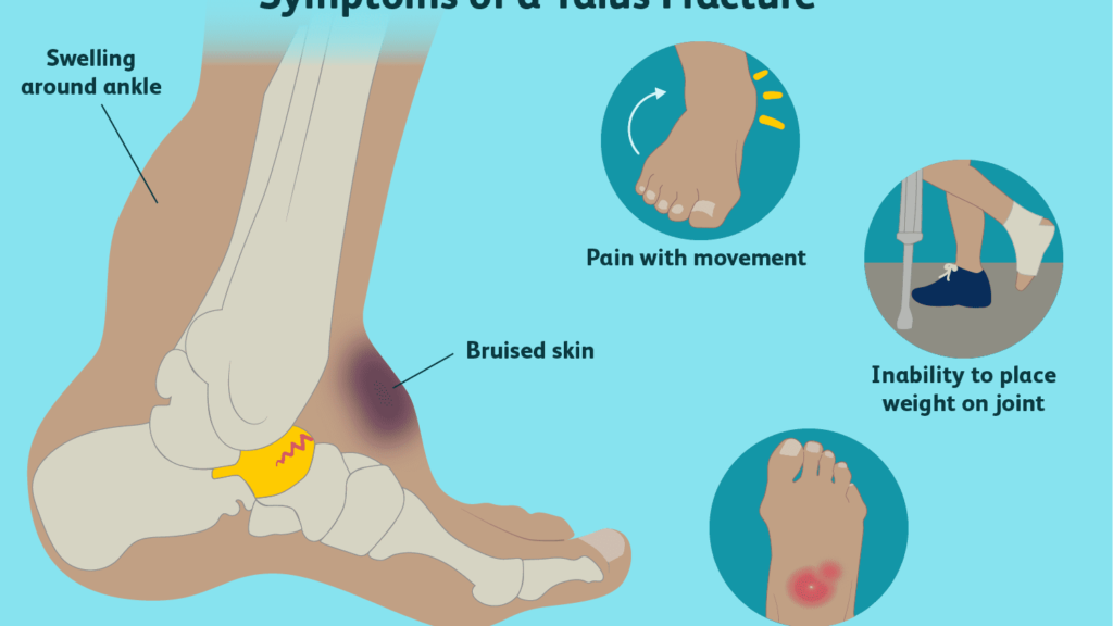 foot and ankle fracture